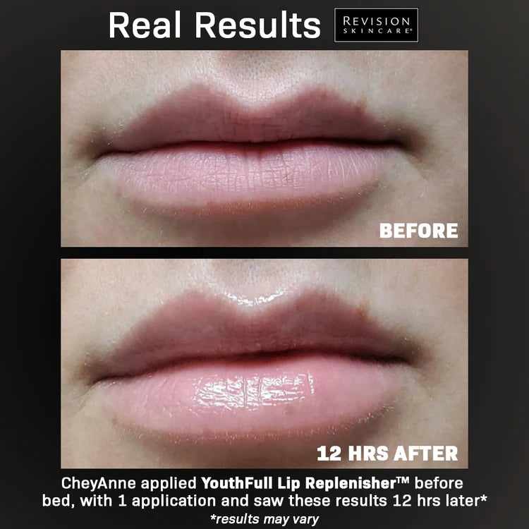 Revision YouthFull Lip Replenisher